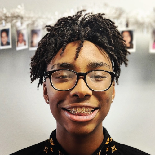 aces of braces league city tx smile gallery image