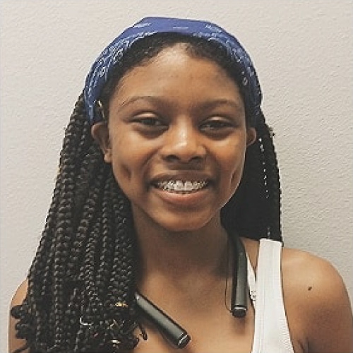 aces of braces league city tx smile gallery image