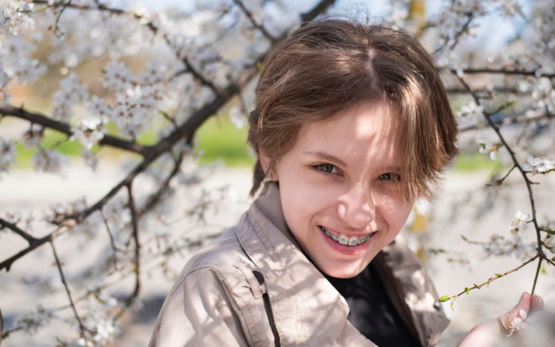 Brightening Your Braces for Spring