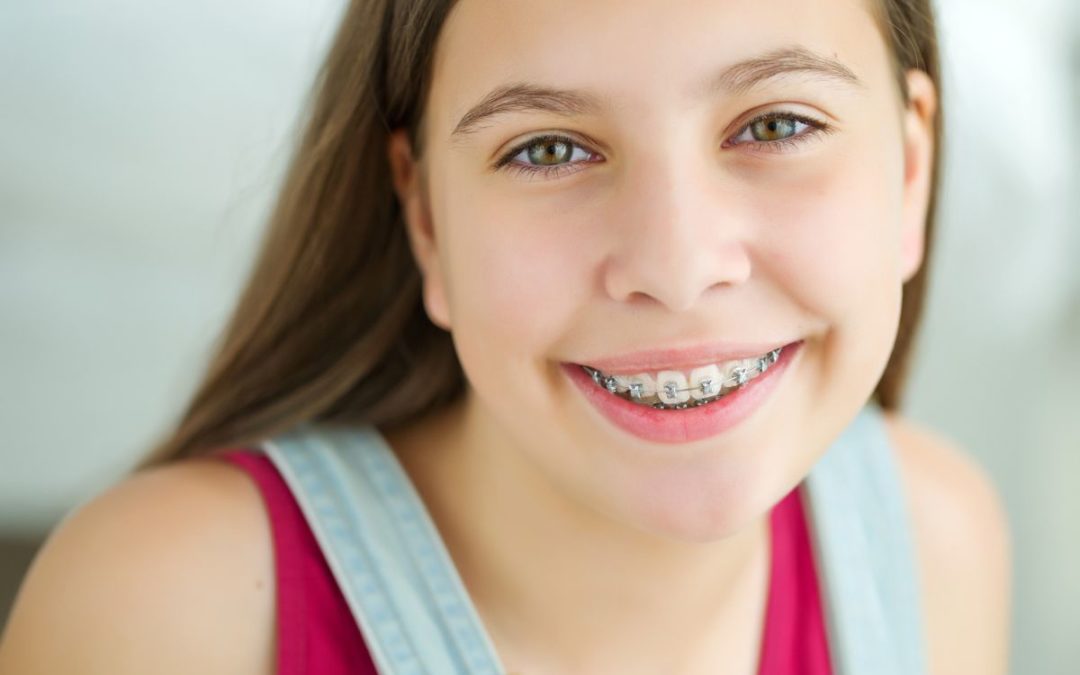 Braces Care on the Road
