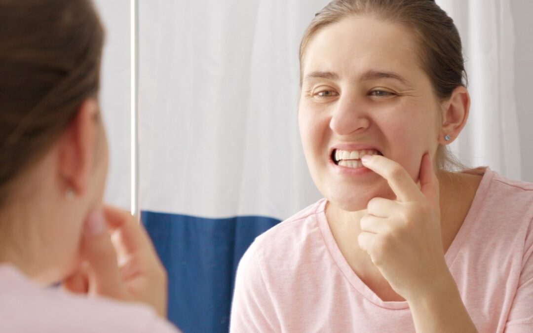 Why Are My Gums Inflamed?