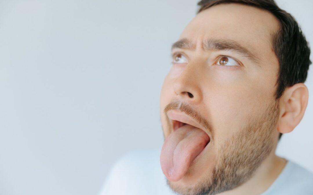 How to Get Rid of a Fissured Tongue: Causes, Symptoms, and Effective Solutions