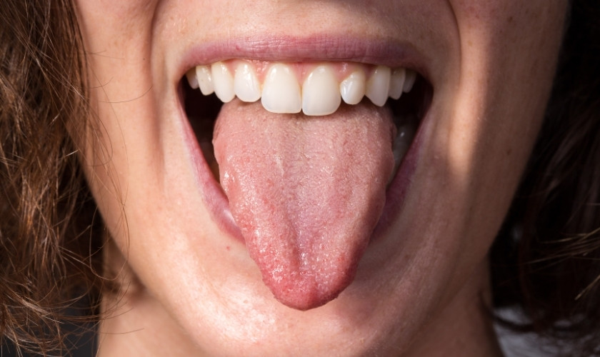 Sore Tongue After Dental Work