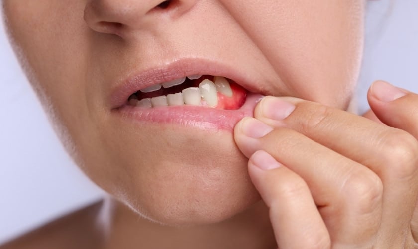 Why do My Gums Hurt in One Spot?