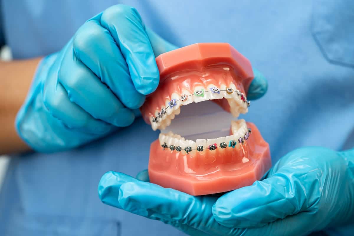 Braces in League City