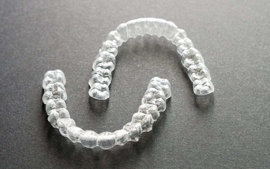 Invisalign Candidacy in League City, TX