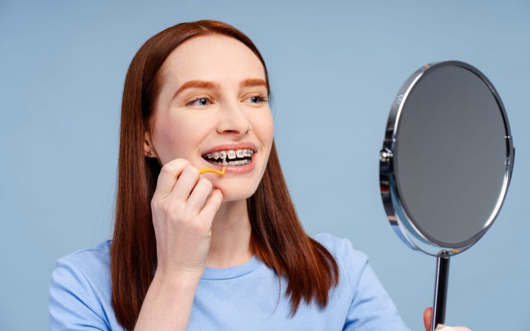 Will Your Braces Results Last Forever, Or Do They Need Maintenance