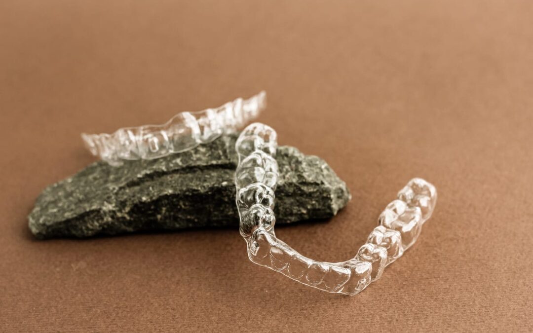Your Invisalign Journey Isn’t Over: Why Retainers Matter Most